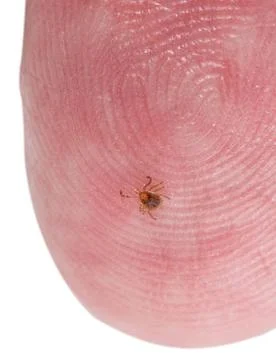 Tiny deer tick on finger tip of man Extremely tiny nymph or larva stage of... Stock-Fotos