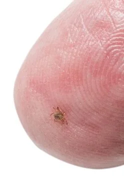 Tiny deer tick on finger tip of man Extremely tiny nymph or larva stage of... Stock-Fotos