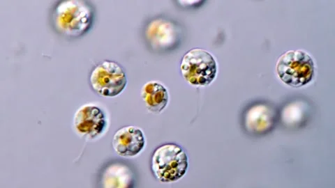 Tiny Flagellated Algae Moving in Water Under Magnification, 1000x Stock-Footage 317016085