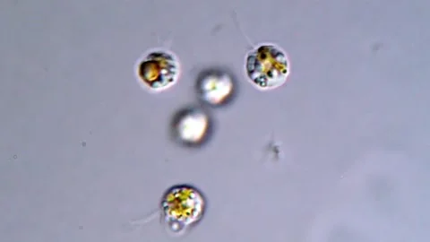 Tiny Flagellated Cells Moving Rapidly Under Magnification, 1000x Stock-Footage 317015759