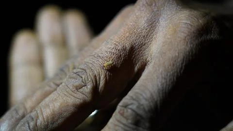 Tiny insect crawling on human hand skin texture detail Stock Photos