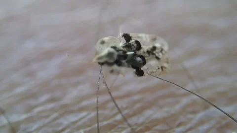Tiny insect on human skin Stockbeeldmateriaal 125336060