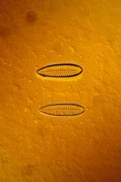 Tiny microscopic diatoms in drops of water Stock Photos
