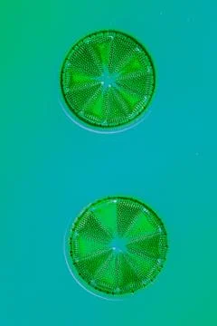 Tiny microscopic diatoms in drops of water Stock Photos