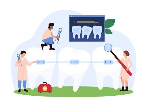 Tiny people working on dental braces concept Illustration