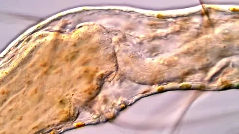 Tiny Transparent Aeolosoma Worm Seen in Detail, microscope view 400x Stock Footage 317926876