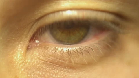 Tired eye Stock Footage 111664002