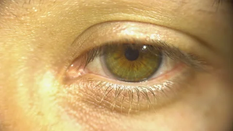 Tired eye Stock Footage 111725311