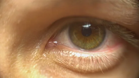 Tired eye Stock Footage 111725362