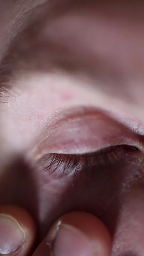 Tired strained eye from long smartphone use Stock Footage 329755392