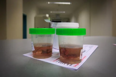 Tissue samples are placed in formalin for subsequent examination by a patho.. Stock Photos