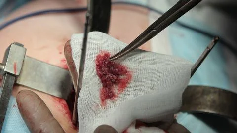 Tissues Removed Close Up Stockfoto's