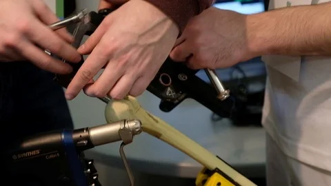 Titanium rods in the bone Stock Footage 89567600