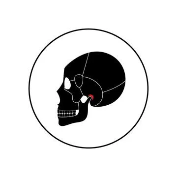 TMD TMJ disorder Stock Illustration