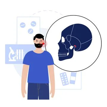 TMD TMJ disorder Illustrazione stock