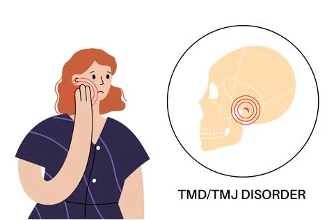 TMD TMJ disorder Stock Illustration