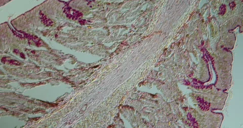 toad Small intestine tissue | Stock Video | Pond5