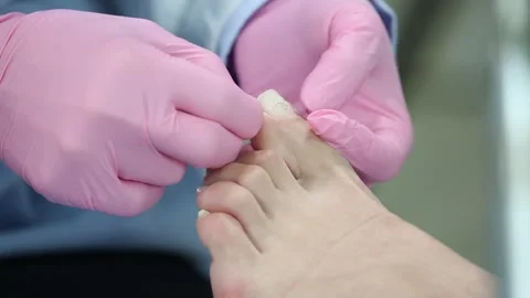 Toenail care 2 Stock Footage 327399846