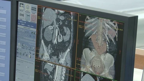 Tom Stock Footage 103103333