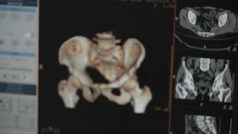 Tomograph display in the tomography chamber 2 Stock Footage 101478656