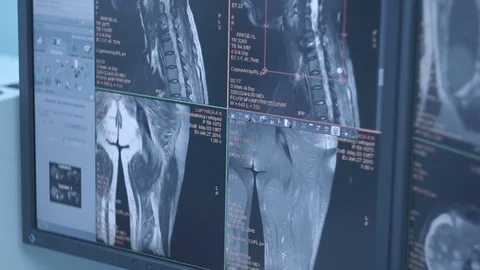Tomograph display in the tomography chamber Stock Footage 101478672
