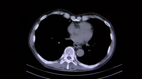 Tomography 02 Video stock 309181