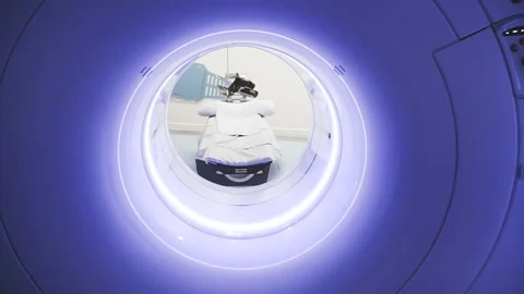 Tomography. CT scan Vídeos de archivo 100083409