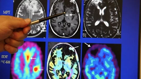 Tomography Stock Footage 6197749