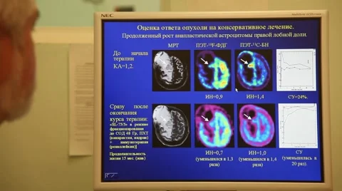 Tomography Stock Footage 6198095