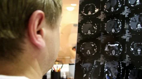 Tomography Stock Footage 22134272