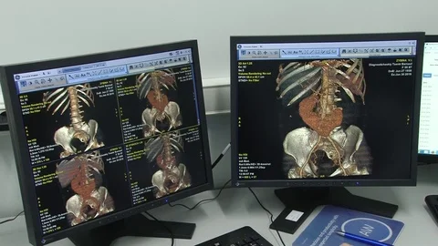 Tomography Stock Footage 103091611