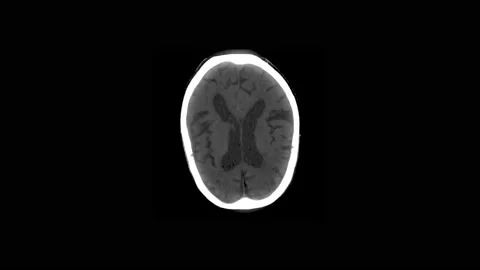 Tomography MRI, CT head examining brain. Stock Footage 169004045