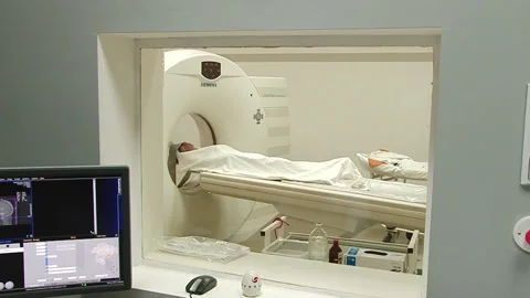 Tomography of the patient's head Stock Footage 130793986