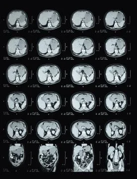 Tomography Stock Photos