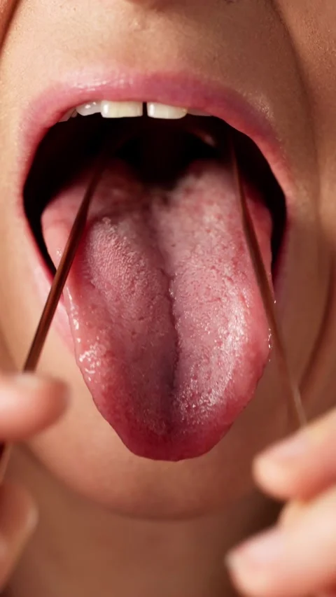 Tongue Cleaner Brush Or Scraper Stock Footage 301832563