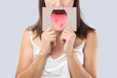 Tongue problems Foto stock