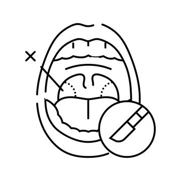 Tonsillectomy surgery line icon vector illustration Ilustração Stock