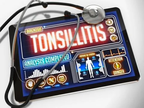 Tonsillitis on the Display of Medical Tablet Stock Illustration
