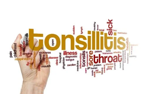 Tonsillitis Stock Illustration