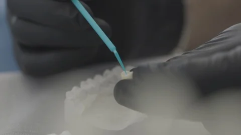 Tools Of Dentist Stock Footage 87860817