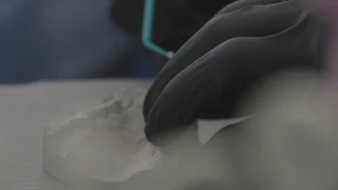 Tools Of Dentist Stock Footage 87861218