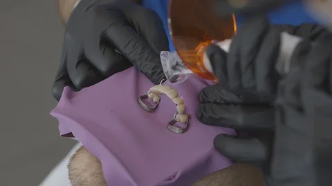 Tools Of Dentist Stock Footage 87862011