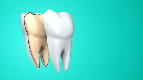Tooth with Bacteria Germs Explaining Dental Hygiene and Oral Health Stock Illustration