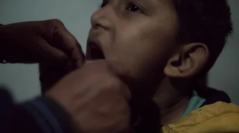 Tooth being pulled 動画素材 46018866