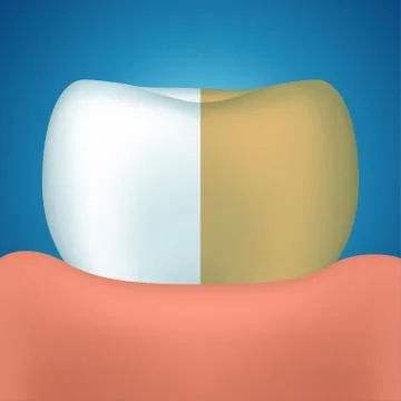 Tooth on blue Stock Illustration