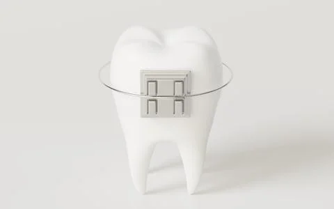 Tooth brace in the white background, 3d rendering. Stock Illustration