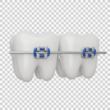 Tooth braces 3D icon Stock Illustration