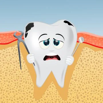 Tooth with caries and tartar Stock Illustration