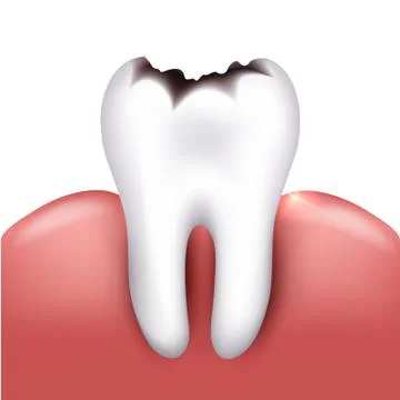 Tooth with caries Stock Illustration