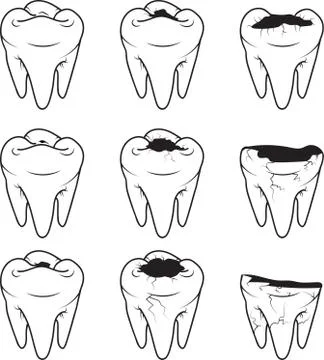 Tooth Caries vector icon. Outline Stock Illustration